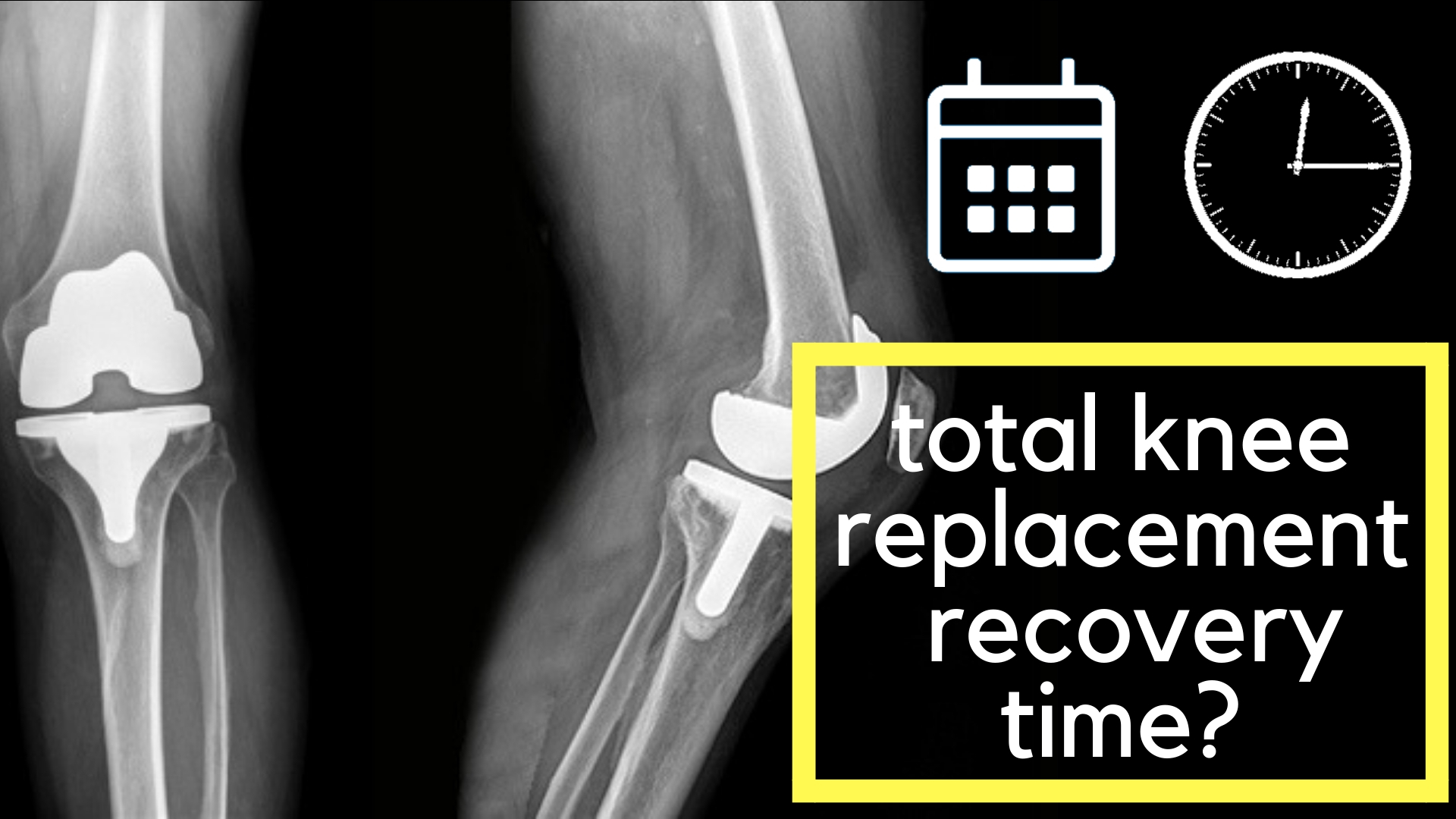 Rehab Time For Total Knee Replacement