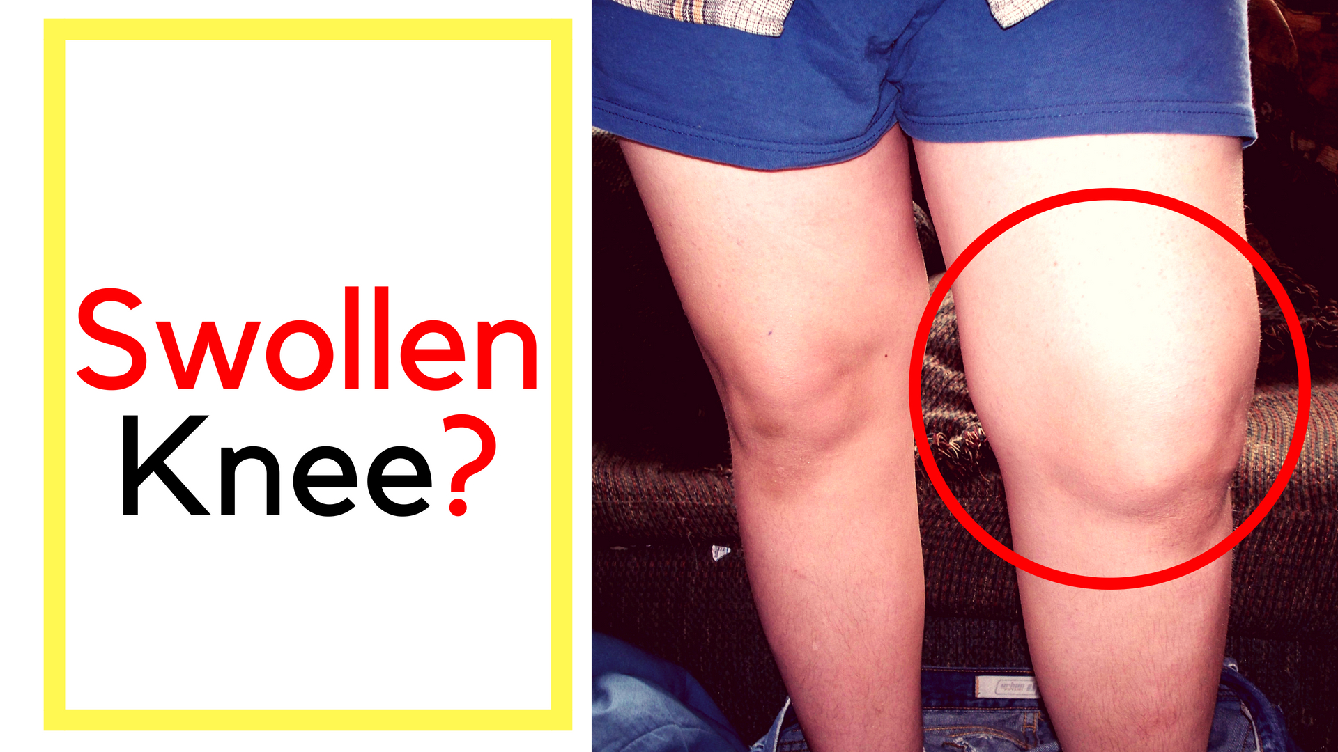 What To Do With Swollen Knee Joint Injury That Causes Swelling Inflammation And Knee Pain Aw