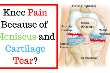 Knee Pain Because of Meniscus and Cartilage Tear_