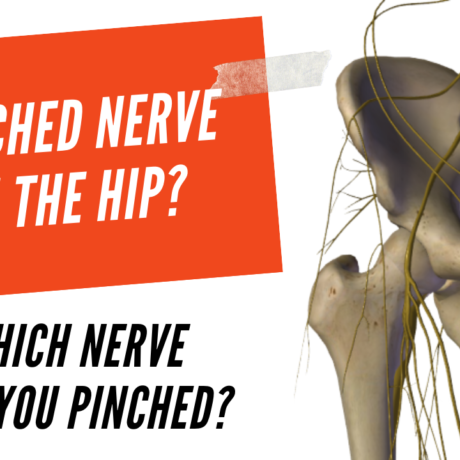 Pinched Nerve In Hip Everything To Know About Treatme - vrogue.co