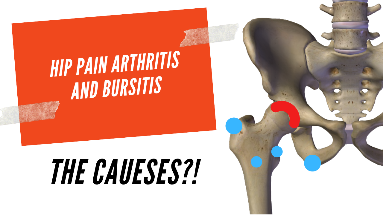 Hip pain Arthritis / Bursitis - AW BOON WEI