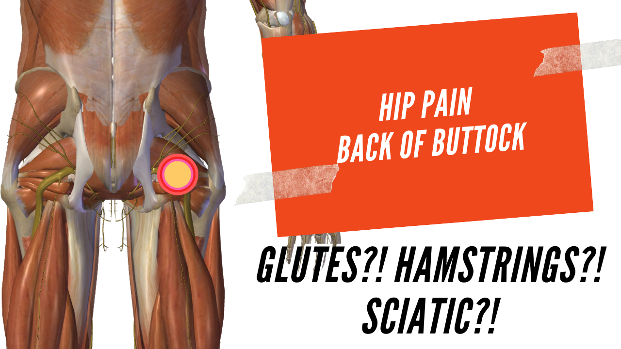 Severe Pain In Left Buttock And Thigh When Walking